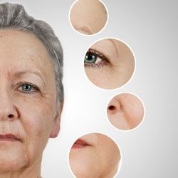 Argireline® – botox hatású peptid a mimikai ráncok ellen